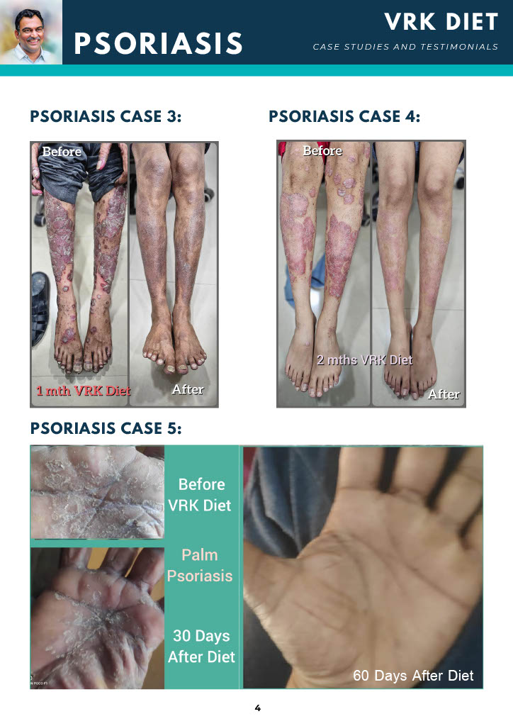 VRK Diet Case Studies (2) (2)1024_6