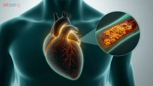 Read more about the article When Young Hearts Fall Silent: The Hidden Crisis Behind Early Heart Attacks